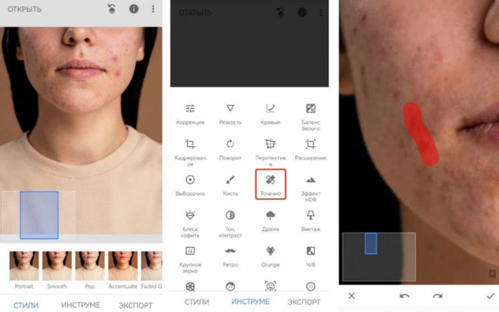 удаление покраснений