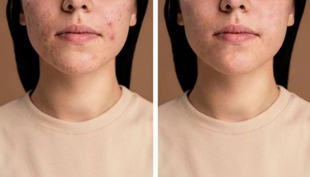 экспорт итогового результата