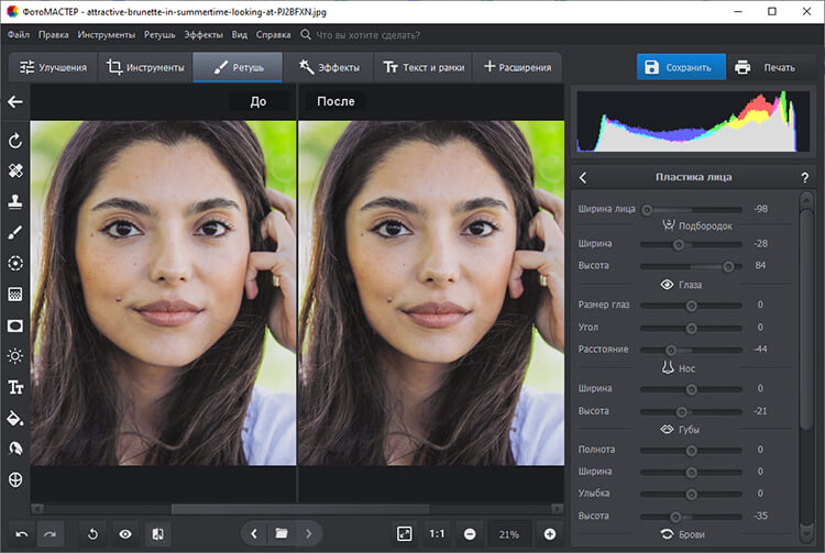 Пластика лица